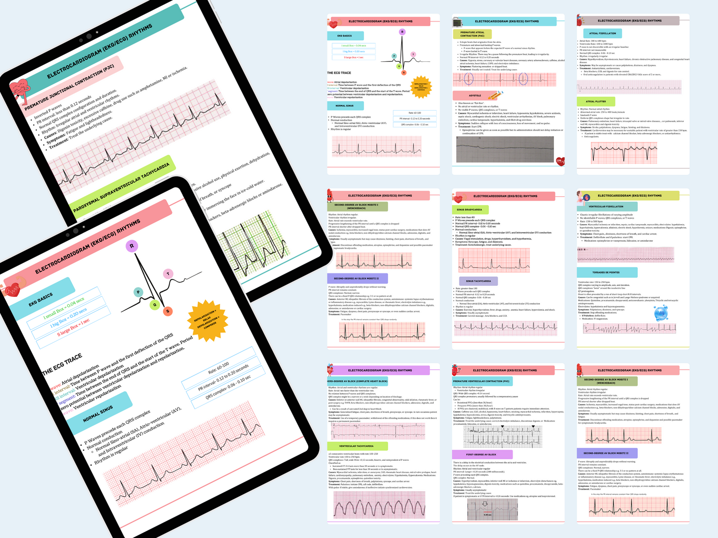 EKG Study