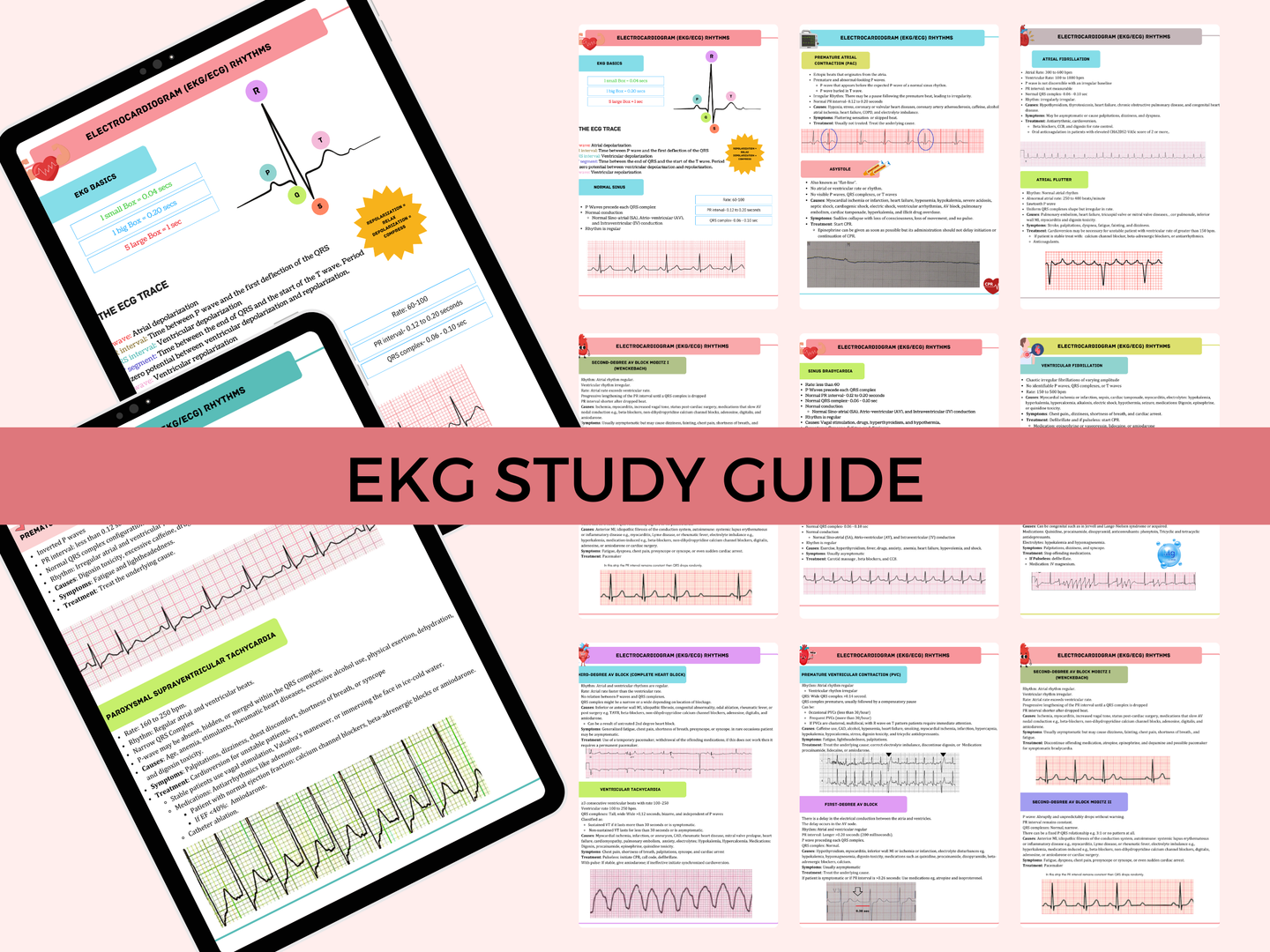 EKG Study