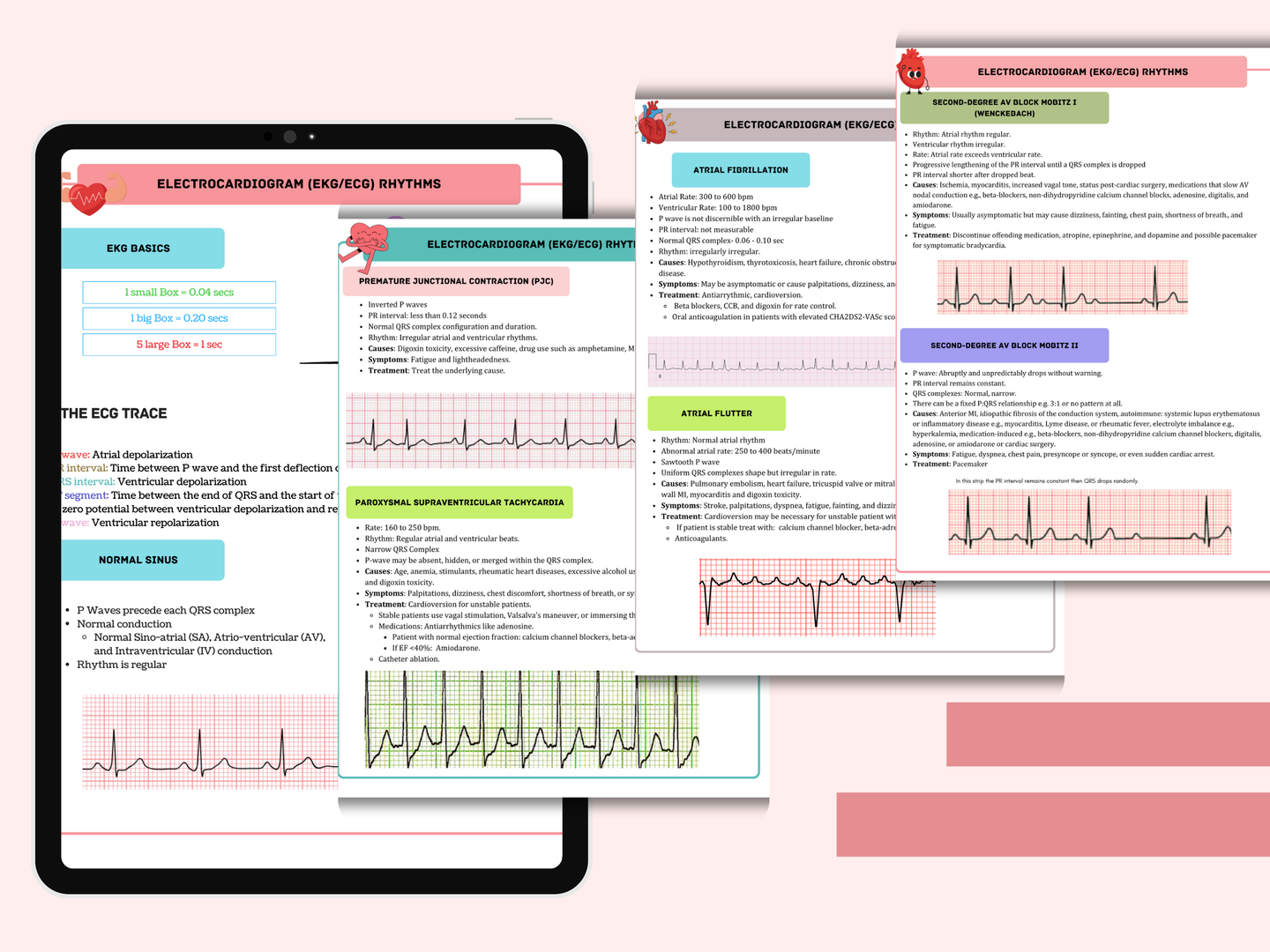 EKG Study