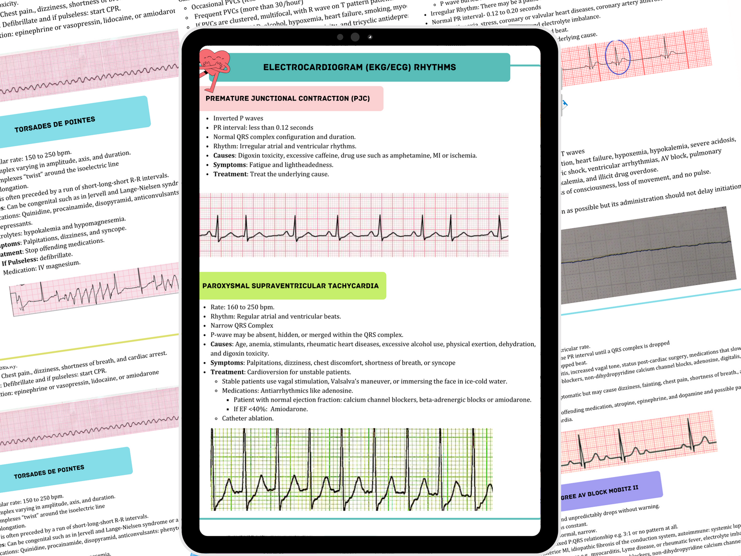 EKG Study